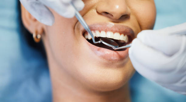 Best Emergency Root Canal Treatment in Fairfield, CA