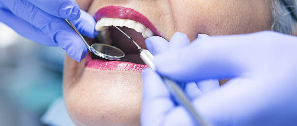 Best Emergency Root Canal Treatment in Fairfield, CA
